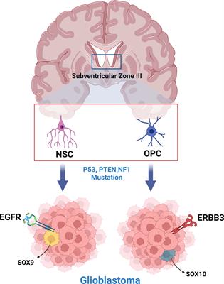 Opinion: Bridging gaps and doubts in glioblastoma cell-of-origin